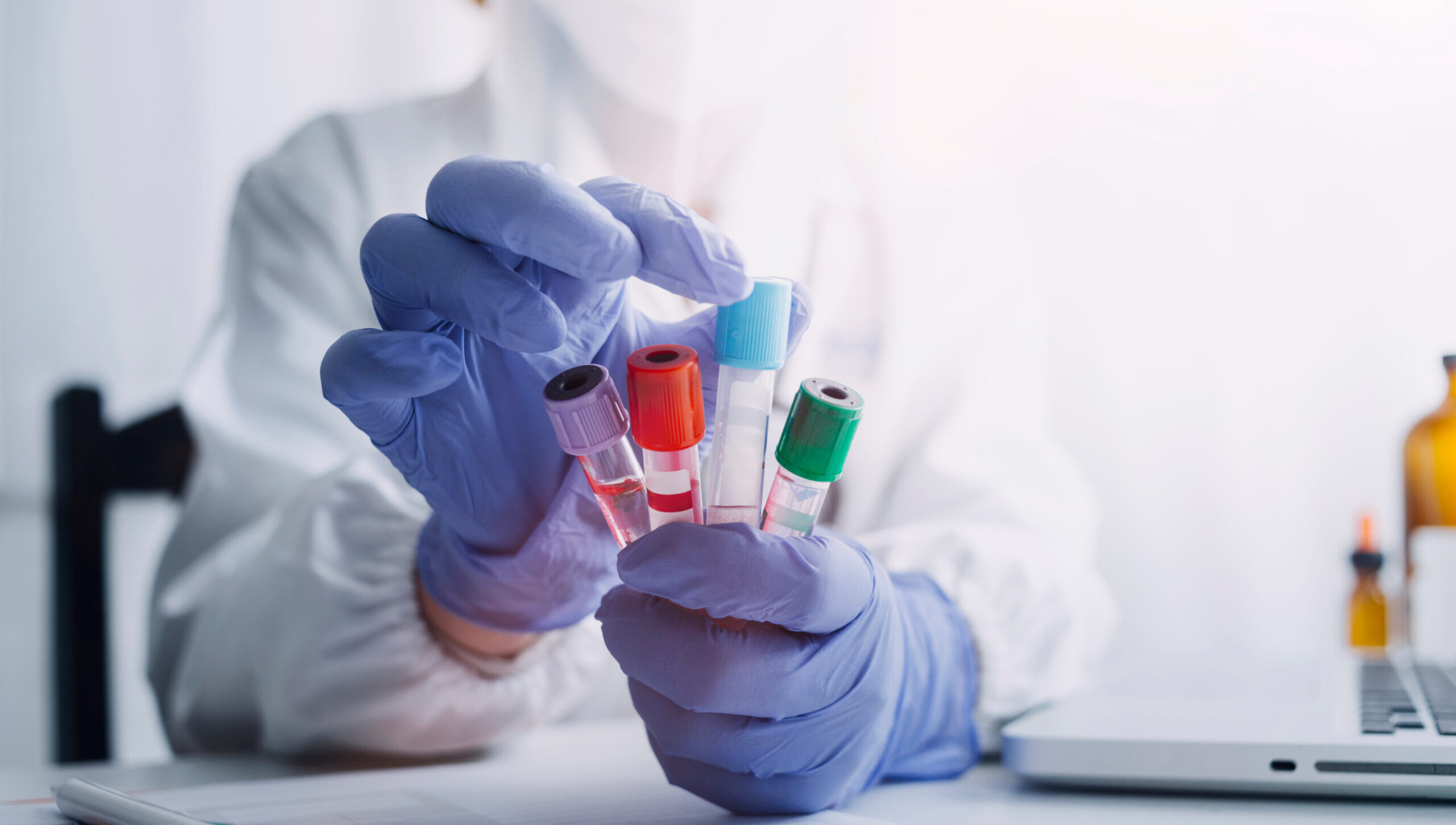 doctor hand taking a blood sample tube from a rack with machines